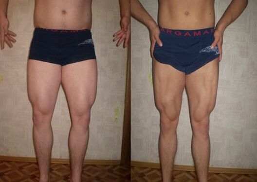 keto dieta jarraitu aurretik eta ondoren